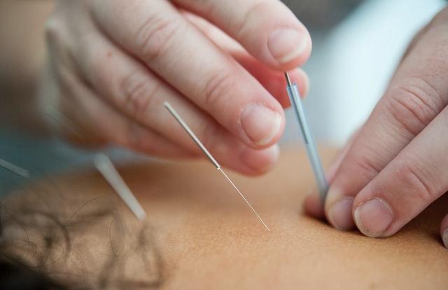 Akupunktur bei Inkontinenz